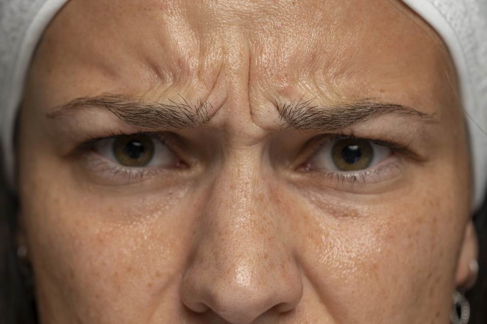 haragos ránc eltüntetése